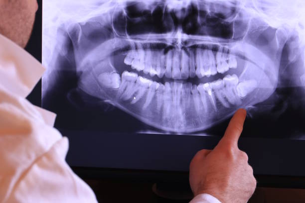 Best Emergency Gum Pain Relief  in Overland Park, KS