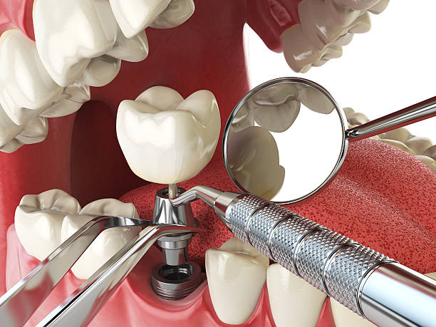 Best Urgent Tooth Repair  in Overland Park, KS
